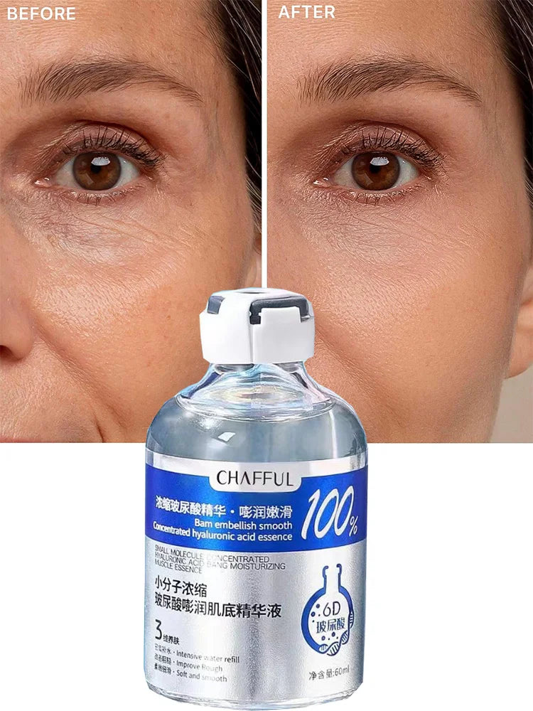 2Pcs Hyaluronic Acid Facial Essence Deep Moisturizing Facial Skin Essence Korean Skin Care Products Reduces Dry Skin